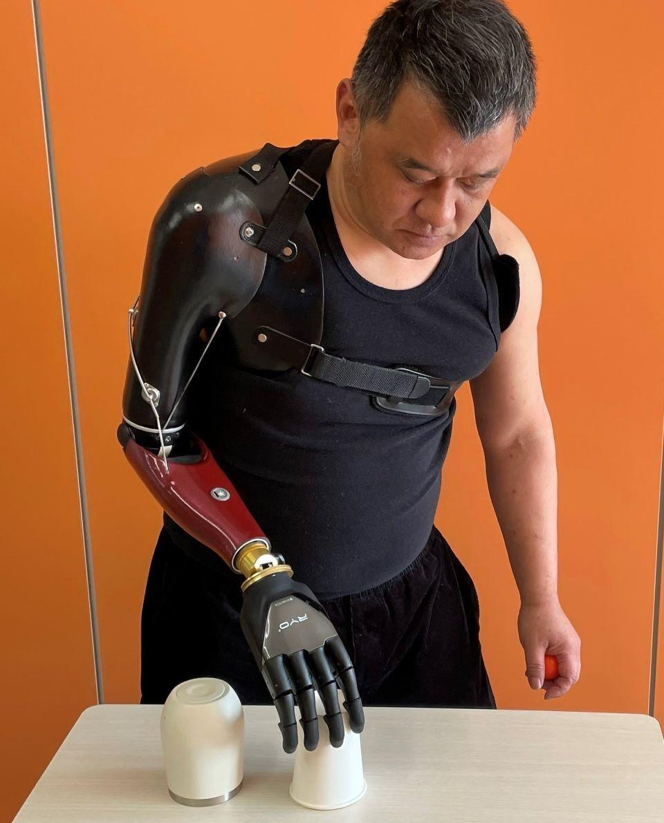 Bionic Prosthetics Prototypes Hand in bionic hand: The new age of accessible, high-tech prosthetics ...