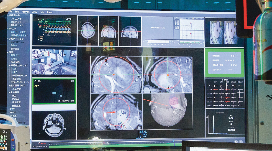 Ultra high-definition 4K monitors showing comprehensive information from various medical devices within the SCOT theater.