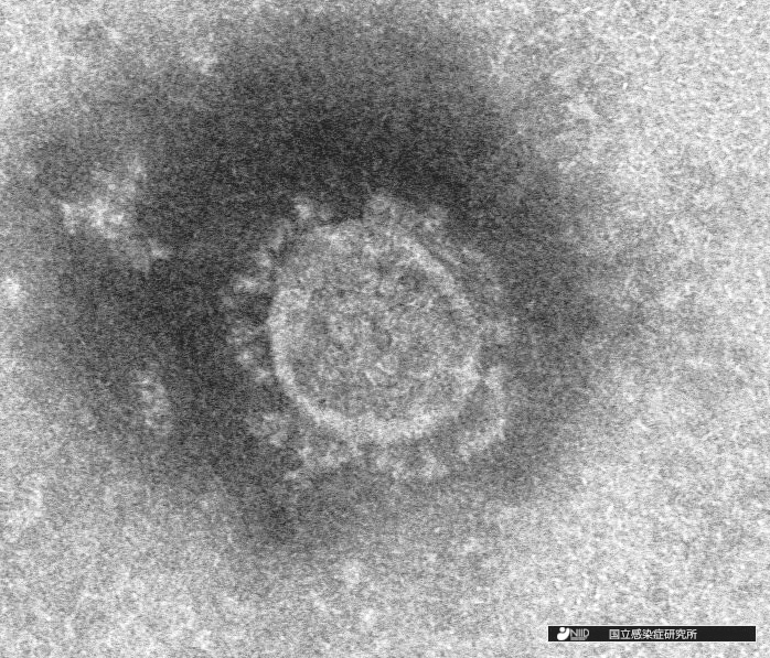 Electron-microscope image of the novel coronavirus isolated at the National Institute of Infectious Diseases (NIID) in Japan.