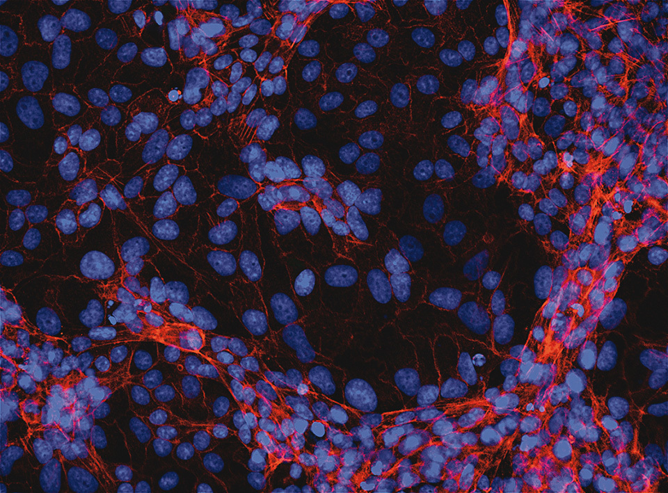 VeroE6 cells alone