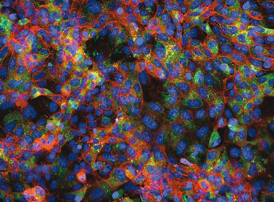 VeroE6 cells exposed to SARS-CoV-2