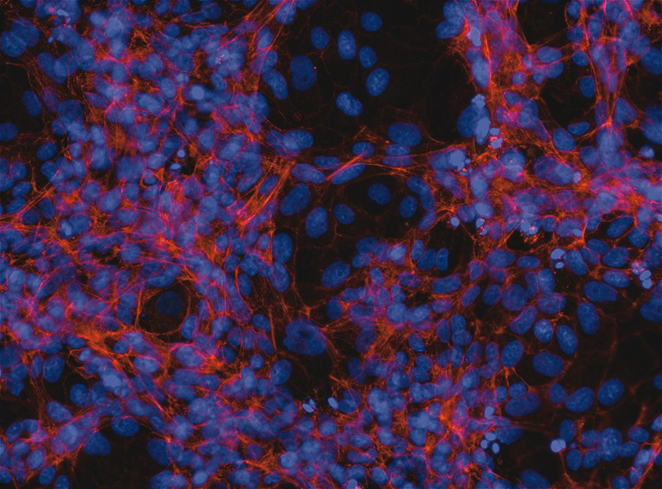 VeroE6 cells exposed to SARS-CoV-2 but protected by GRL